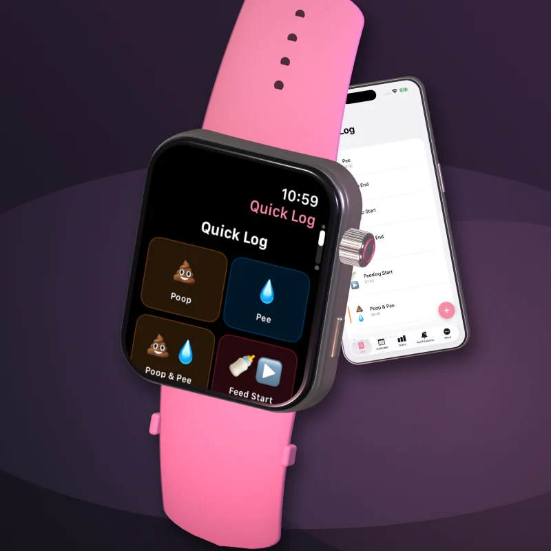 Close-up of Baby Log Day quick actions on Apple Watch, with the paired iPhone behind it
